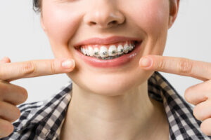 braces before and after consult